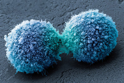 Cancers-3