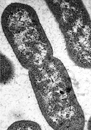 bacteries-microscope.jpg