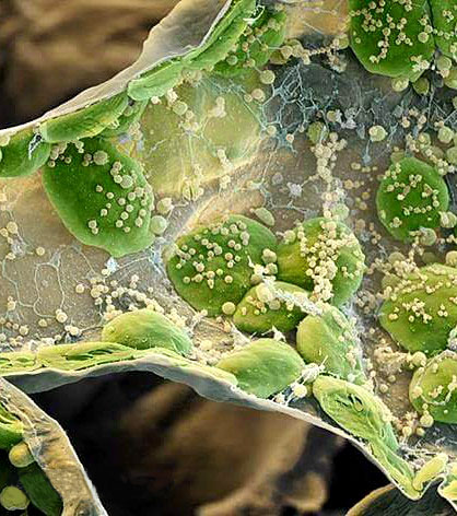 chloroplaste-microscope-electro.jpg