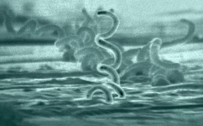 treponema_pallidum.jpg
