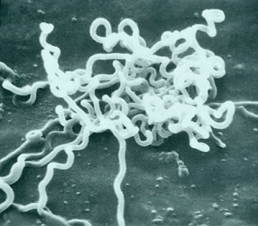 treponemapallidum.jpg