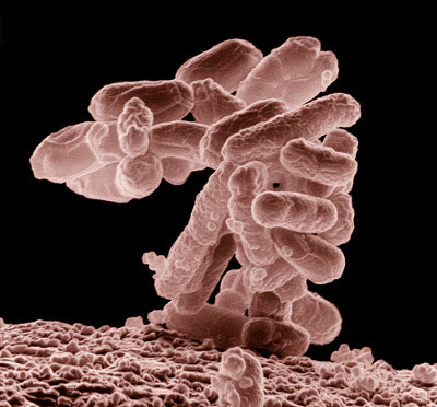 escherichia-coli.jpg